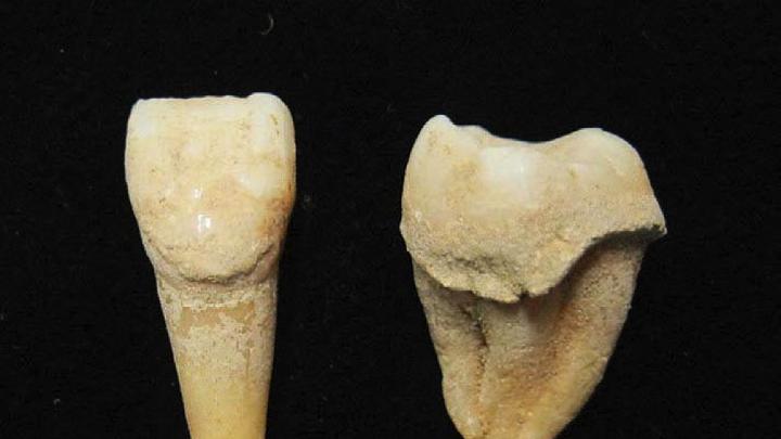 Two teeth from a man who lived 3,200 years ago, the plaque on which shows that his diet included sheep and goat milk.